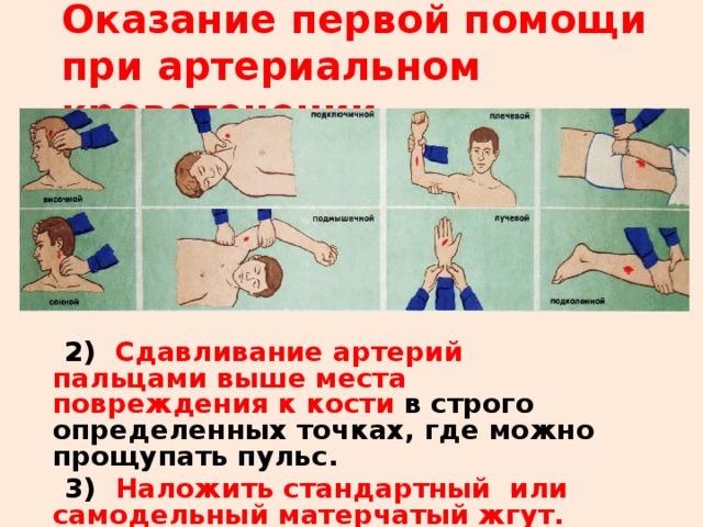Оказание первой помощи при артериальном  кровотечении  2) Сдавливание артерий пальцами выше места повреждения к кости в строго определенных точках, где можно прощупать пульс.  3) Наложить стандартный или самодельный матерчатый жгут. 