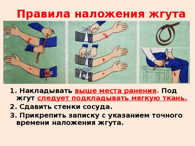 Правила наложения жгута 1. Накладывать выше места ранения . Под жгут следует подкладывать мягкую ткань. 2. Сдавить стенки сосуда. 3. Прикрепить записку с указанием точного времени наложения жгута. 