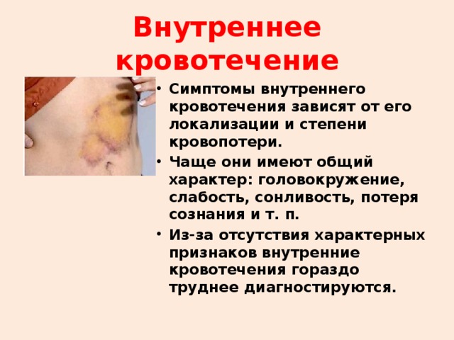 Внутреннее кровотечение Симптомы внутреннего кровотечения зависят от его локализации и степени кровопотери. Чаще они имеют общий характер: головокружение, слабость, сонливость, потеря сознания и т. п. Из-за отсутствия характерных признаков внутренние кровотечения гораздо труднее диагностируются. 