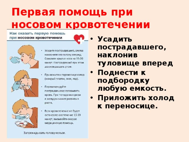 Первая помощь при носовом кровотечении Усадить пострадавшего, наклонив туловище вперед Поднести к подбородку любую емкость. Приложить холод к переносице. 