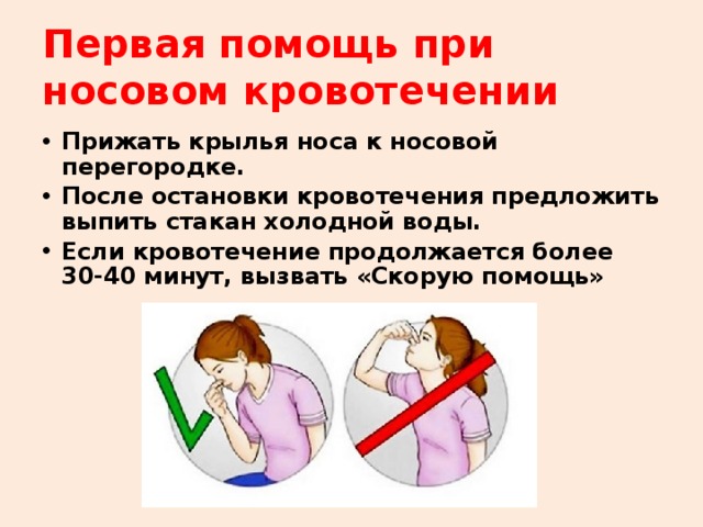 Первая помощь при носовом кровотечении Прижать крылья носа к носовой перегородке. После остановки кровотечения предложить выпить стакан холодной воды. Если кровотечение продолжается более 30-40 минут, вызвать «Скорую помощь»  