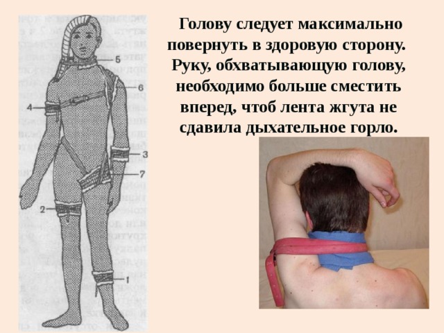  Голову следует максимально повернуть в здоровую сторону.  Руку, обхватывающую голову, необходимо больше сместить вперед, чтоб лента жгута не сдавила дыхательное горло. 