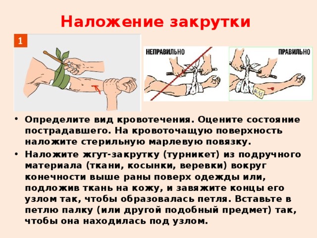 Наложение закрутки Определите вид кровотечения. Оцените состояние пострадавшего. На кровоточащую поверхность наложите стерильную марлевую повязку. Наложите жгут-закрутку (турникет) из подручного материала (ткани, косынки, веревки) вокруг конечности выше раны поверх одежды или, подложив ткань на кожу, и завяжите концы его узлом так, чтобы образовалась петля. Вставьте в петлю палку (или другой подобный предмет) так, чтобы она находилась под узлом.  