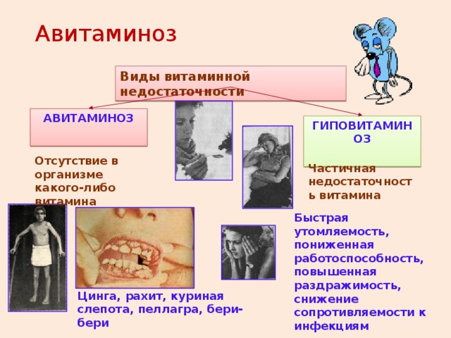 Авитаминоз Виды витаминной недостаточности АВИТАМИНОЗ  ГИПОВИТАМИНОЗ  Отсутствие в организме какого-либо витамина Частичная недостаточность витамина Быстрая утомляемость, пониженная работоспособность, повышенная раздражимость, снижение сопротивляемости к инфекциям Цинга, рахит, куриная слепота, пеллагра, бери-бери 