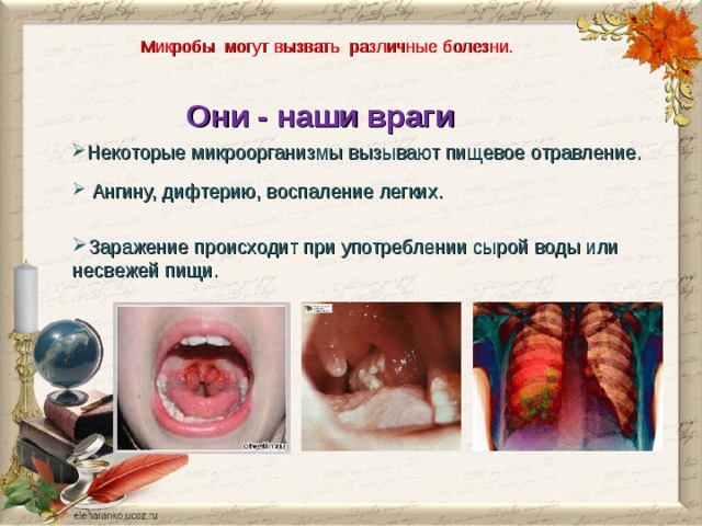 Микробы могут вызвать различные болезни. Они - наши враги Некоторые микроорганизмы вызывают пищевое отравление.   Ангину, дифтерию, воспаление легких.  Ангину, дифтерию, воспаление легких. Заражение происходит при употреблении сырой воды или несвежей пищи. Заражение происходит при употреблении сырой воды или несвежей пищи. 