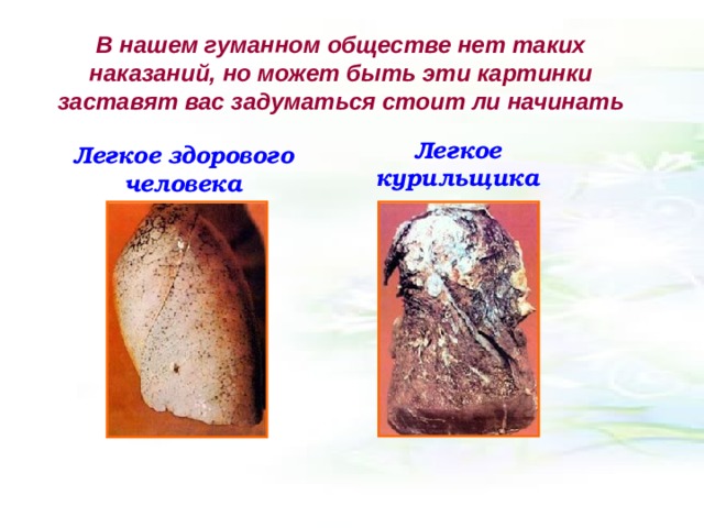 В нашем гуманном обществе нет таких наказаний, но может быть эти картинки заставят вас задуматься стоит ли начинать Легкое курильщика Легкое здорового человека 