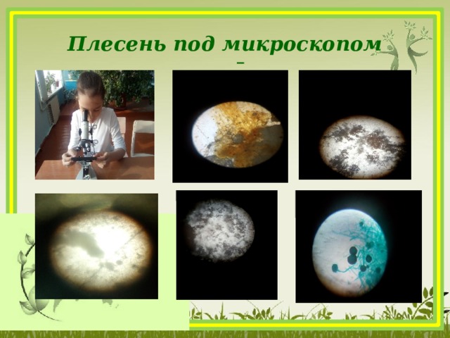 Плесень под микроскопом     