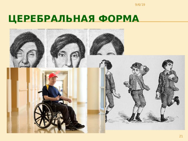 9/6/19 Церебральная форма 20 
