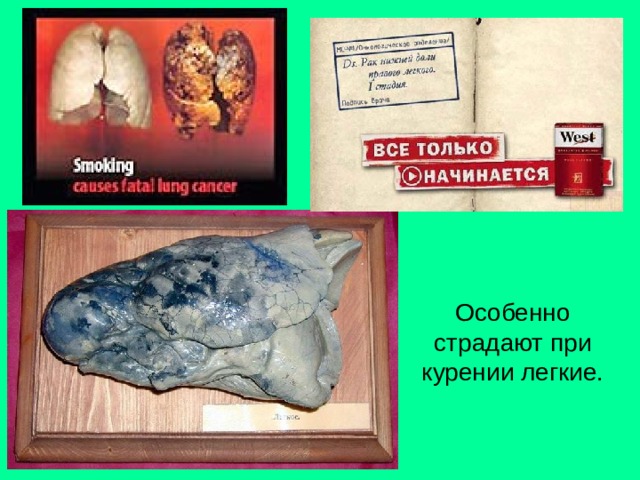Особенно страдают при курении легкие. 