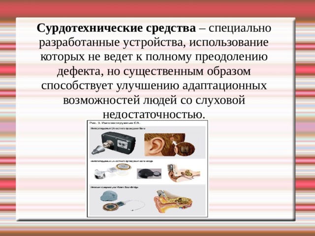 Сурдотехнические средства – специально разработанные устройства, использование которых не ведет к полному преодолению дефекта, но существенным образом способствует улучшению адаптационных возможностей людей со слуховой недостаточностью. 