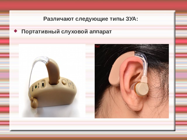 Различают следующие типы ЗУА:  Портативный слуховой аппарат   