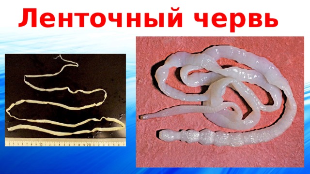 Ленточный червь 