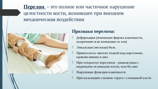 Перелом  - это полное или частичное нарушение целостности кости, возникшее при внешнем механическом воздействии Признаки перелома: Деформация (изменение формы конечности, укорочение или изменение ее оси) Локальная (местная) боль Припухлость мягких тканей над переломом, кровоизлияние в них При открытых переломах - рваная рана с видимыми отломками кости, или без них Нарушение функции конечности При пальпации слышен «хруст» сломанной кости 