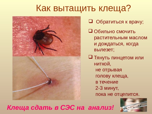 Как вытащить клеща? Обратиться к врачу; Обильно смочить растительным маслом и дождаться, когда вылезет; Тянуть пинцетом или ниткой,  не отрывая  голову клеща,  в течение  2-3 минут,  пока не отцепится. Клеща сдать в СЭС на анализ!