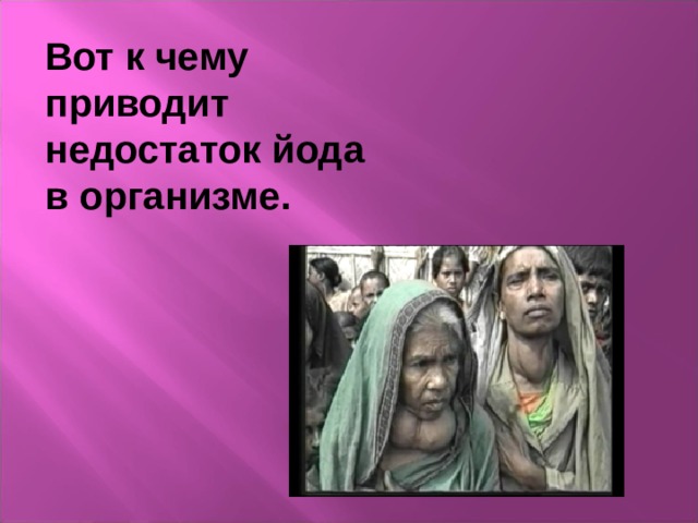 Вот к чему приводит недостаток йода в организме. 
