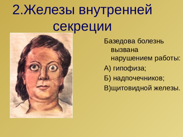 2.Железы внутренней секреции Базедова болезнь вызвана нарушением работы: А) гипофиза; Б) надпочечников; В)щитовидной железы. 