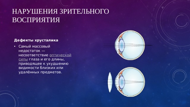 Нарушения зрительного восприятия Дефекты хрусталика Самый массовый недостаток — несоответствие  оптической силы  глаза и его длины, приводящее к ухудшению видимости близких или удалённых предметов. 