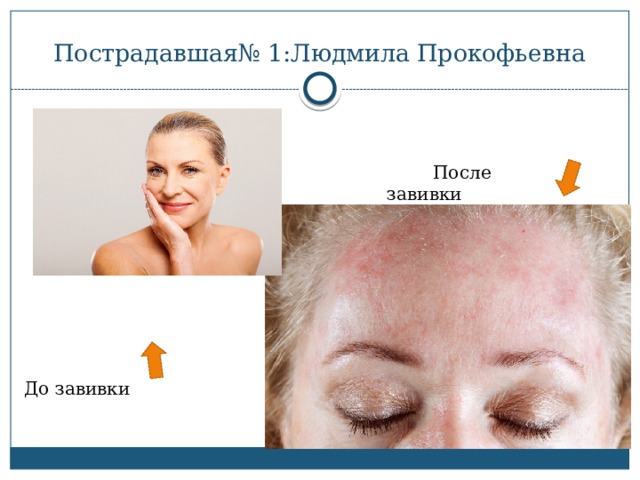 Пострадавшая№ 1:Людмила Прокофьевна  После завивки До завивки 