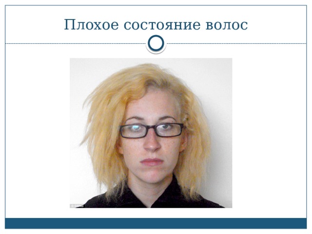 Плохое состояние волос 