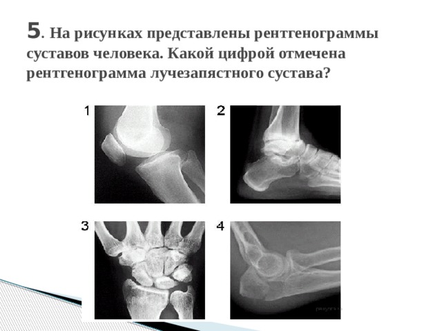 5 .  На рисунках представлены рентгенограммы суставов человека. Какой цифрой отмечена рентгенограмма лучезапястного сустава?   