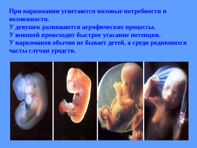 При наркомании угнетаются половые потребности и возможности. У девушек развиваются атрофические процессы. У юношей происходит быстрое угасание потенции. У наркоманов обычно не бывает детей, а среди родившихся часты случаи уродств.  