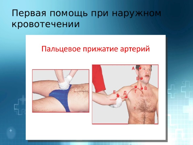 Первая помощь при наружном кровотечении 