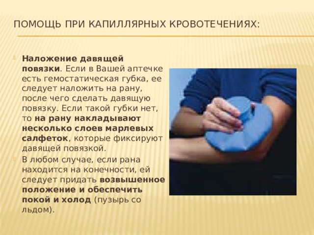 Помощь при капиллярных кровотечениях:   Наложение давящей повязки . Если в Вашей аптечке есть гемостатическая губка, ее следует наложить на рану, после чего сделать давящую повязку. Если такой губки нет, то на рану накладывают несколько слоев марлевых салфеток , которые фиксируют давящей повязкой. В любом случае, если рана находится на конечности, ей следует придать возвышенное положение и обеспечить покой и холод (пузырь со льдом). 