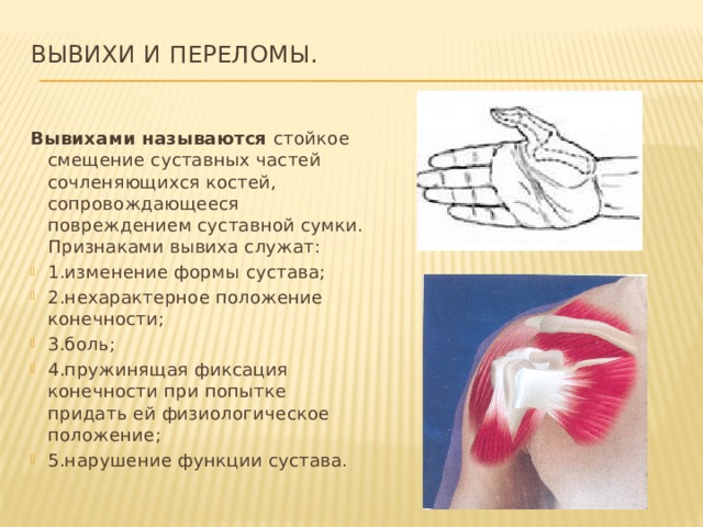 Вывихи и переломы.   Вывихами называются стойкое смещение суставных частей сочленяющихся костей, сопровождающееся повреждением суставной сумки. Признаками вывиха служат: 1.изменение формы сустава; 2.нехарактерное положение конечности; 3.боль; 4.пружинящая фиксация конечности при попытке придать ей физиологическое положение; 5.нарушение функции сустава. 