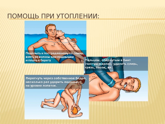 Помощь при утоплении: 