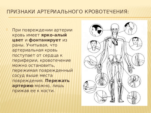 Признаки артериального кровотечения:   При повреждении артерии кровь имеет ярко-алый цвет и фонтанирует из раны. Учитывая, что артериальная кровь поступает от сердца к периферии, кровотечение можно остановить, пережимая поврежденный сосуд выше места повреждения. Пережать артерию можно, лишь прижав ее к кости. 