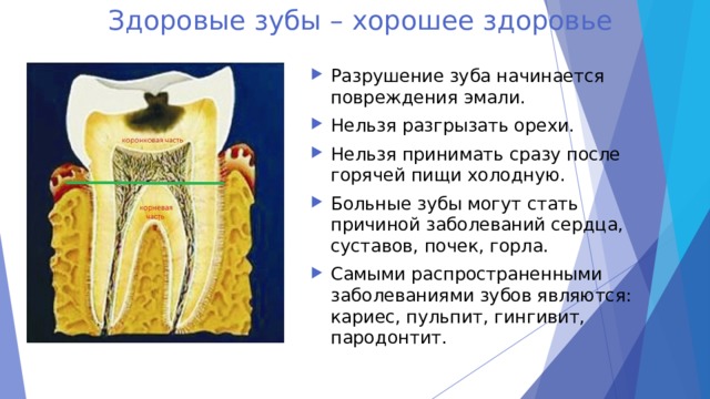 Здоровые зубы – хорошее здоровье Разрушение зуба начинается повреждения эмали. Нельзя разгрызать орехи. Нельзя принимать сразу после горячей пищи холодную. Больные зубы могут стать причиной заболеваний сердца, суставов, почек, горла. Самыми распространенными заболеваниями зубов являются: кариес, пульпит, гингивит, пародонтит.  