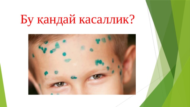 Бу қандай касаллик? 