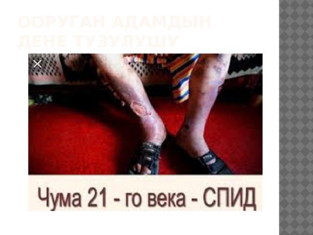 Ооруган адамдын дене тузулушу 