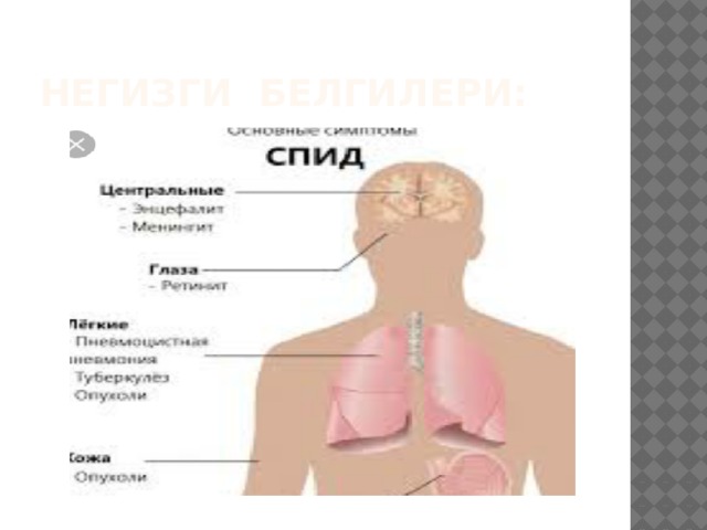 негизги белгилери: 