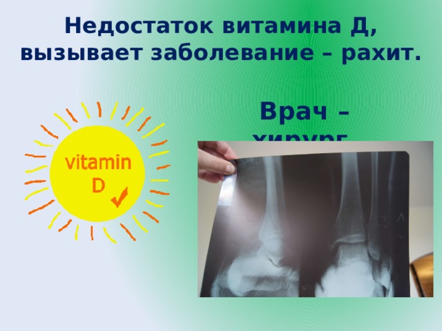 Недостаток витамина Д, вызывает заболевание – рахит. Врач – хирург. 