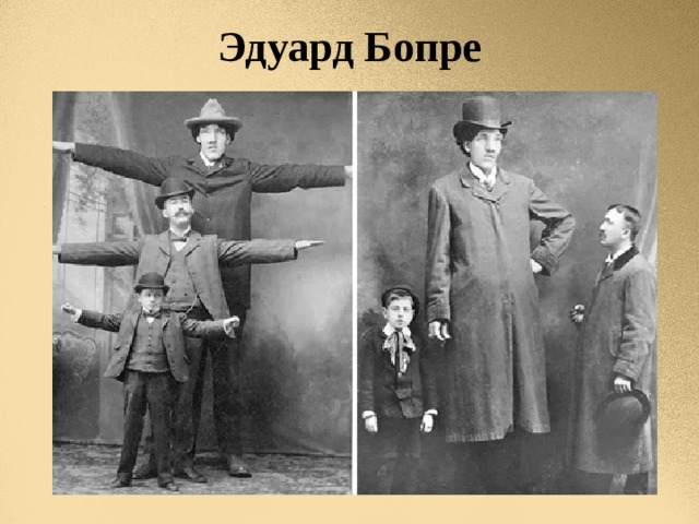 Эдуард Бопре 