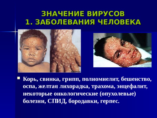 ЗНАЧЕНИЕ ВИРУСОВ  1. ЗАБОЛЕВАНИЯ ЧЕЛОВЕКА Корь, свинка, грипп, полиомиелит, бешенство, оспа, желтая лихорадка, трахома, энцефалит, некоторые онкологические (опухолевые) болезни, СПИД, бородавки, герпес.  
