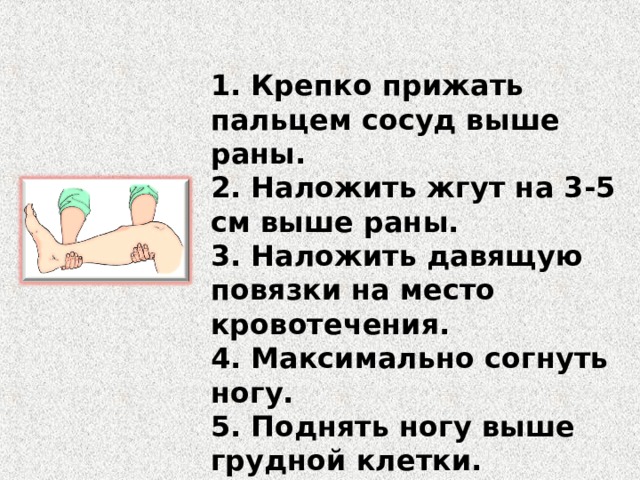 1. Крепко прижать пальцем сосуд выше раны. 2. Наложить жгут на 3-5 см выше раны. 3. Наложить давящую повязки на место кровотечения. 4. Максимально согнуть ногу. 5. Поднять ногу выше грудной клетки. 