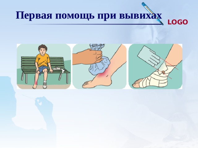 Первая помощь при вывихах 