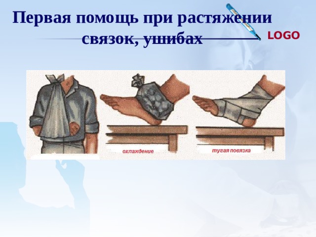 Первая помощь при растяжении связок, ушибах 