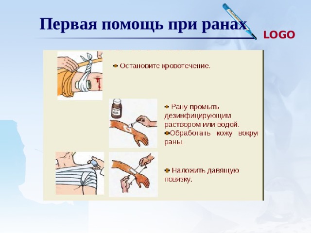 Первая помощь при ранах 