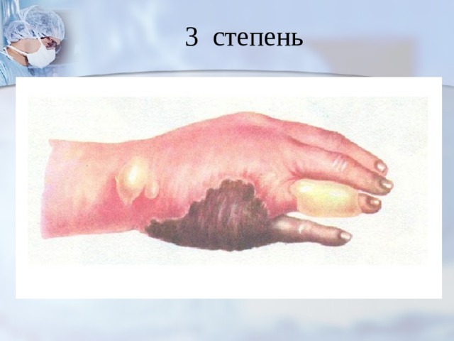3 степень 