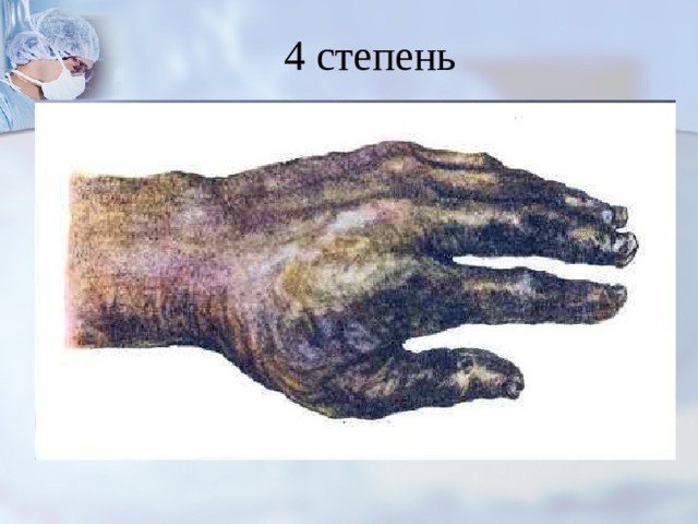4 степень 