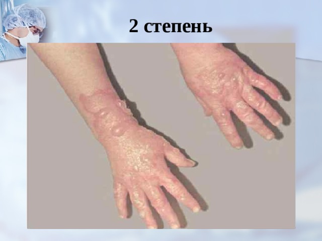 2 степень 