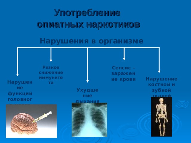 Употребление конопли Нарушения в организме Ослабление иммунитета Тяжелые повреждения головного мозга Хроническая сердечная недостаточность Повышение нагрузки на сердце Хронический бронхит Рак легких 