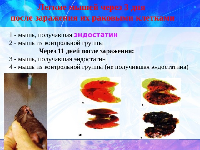 Легкие мышей через 3 дня  после заражения их раковыми клетками   1 - мышь, получавшая эндостатин 2 - мышь из контрольной группы     Через 11 дней после заражения:  3 - мышь, получавшая эндостатин 4 - мышь из контрольной группы (не получившая эндостатина)   