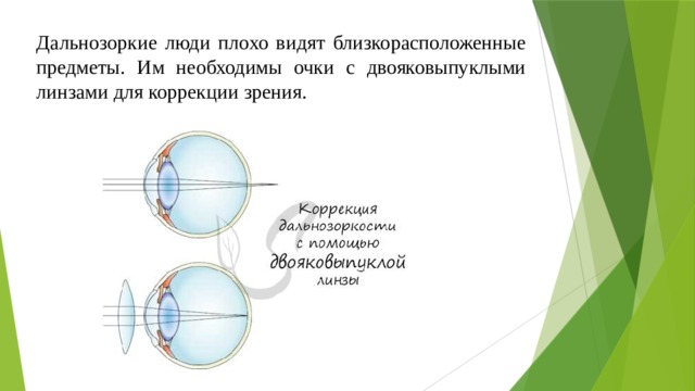 Дальнозоркие люди плохо видят близкорасположенные предметы. Им необходимы очки с двояковыпуклыми линзами для коррекции зрения. 
