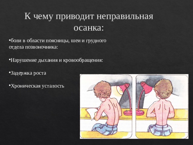 К чему приводит неправильная осанка: боли в области поясницы, шеи и грудного отдела позвоночника:   Нарушение дыхания и кровообращения: Задержка роста   Хроническая усталость   
