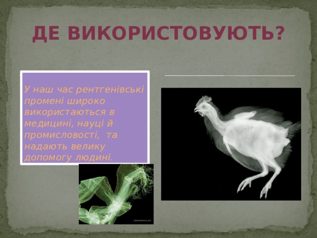Де використовують? У наш час рентгенівські промені широко використаються в медицині, науці й промисловості, та надають велику допомогу людині. 