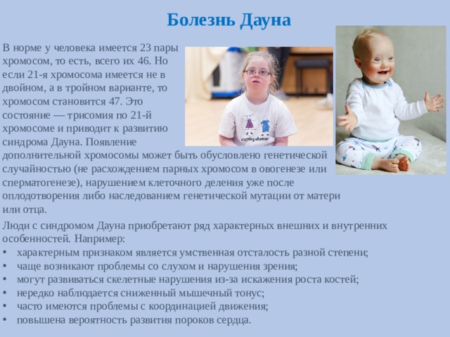 Болезнь Дауна В норме у человека имеется 23 пары  хромосом, то есть, всего их 46. Но  если 21-я хромосома имеется не в  двойном, а в тройном варианте, то  хромосом становится 47. Это  состояние — трисомия по 21-й  хромосоме и приводит к развитию  синдрома Дауна. Появление  дополнительной хромосомы может быть обусловлено генетической случайностью (не расхождением парных хромосом в овогенезе или сперматогенезе), нарушением клеточного деления уже после оплодотворения либо наследованием генетической мутации от матери или отца. Люди с синдромом Дауна приобретают ряд характерных внешних и внутренних особенностей. Например: характерным признаком является умственная отсталость разной степени; чаще возникают проблемы со слухом и нарушения зрения; могут развиваться скелетные нарушения из-за искажения роста костей; нередко наблюдается сниженный мышечный тонус; часто имеются проблемы с координацией движения; повышена вероятность развития пороков сердца. 